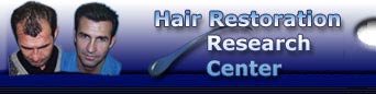 Documents and research papers on hair restoration